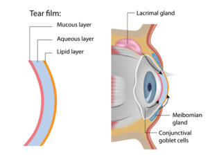 dry eyes and allergies diagram 